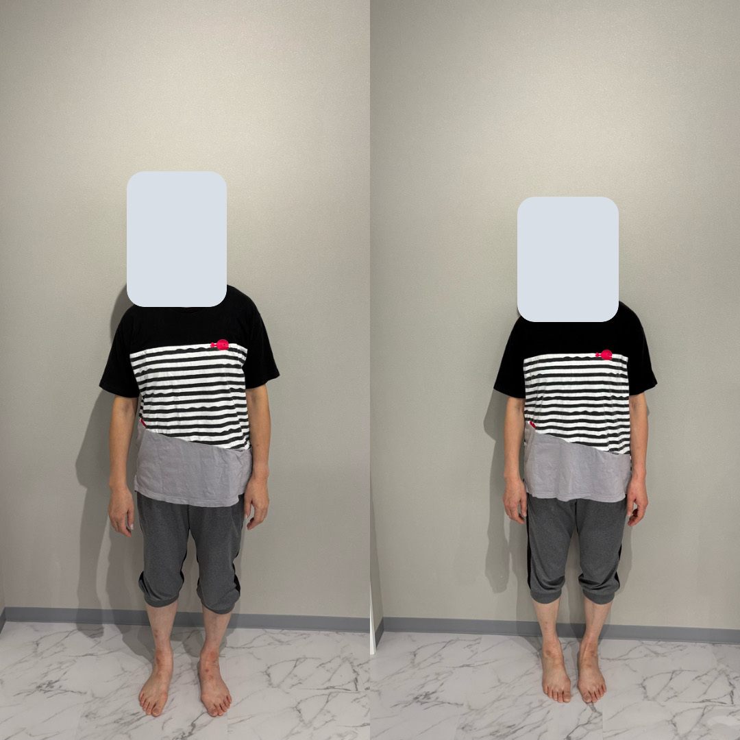 顔を隠したお客様の立ち姿。左がBefore、右がAfter